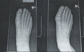 Image result for Amazing Feet Rc, Kidderminster