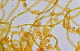 Attēlu rezultāti vaicājumam “Oligonema persimile spores”