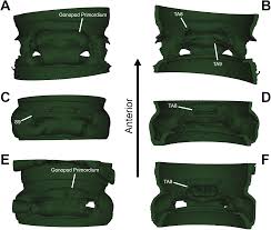 Attēlu rezultāti vaicājumam “Strongylosoma pallipes”