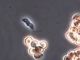 Attēlu rezultāti vaicājumam “Reticularia lycoperdon young”