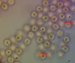 Attēlu rezultāti vaicājumam “Lycogala sp.”