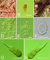 Attēlu rezultāti vaicājumam “Phragmidium sp.”