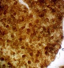 Attēlu rezultāti vaicājumam “Lycogala ustulatum”