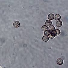 Attēlu rezultāti vaicājumam “Reticularia sp.”