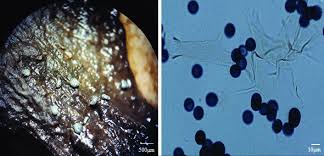 Attēlu rezultāti vaicājumam “Badhamia affinis var. microspora spores”