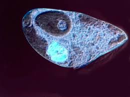 Attēlu rezultāti vaicājumam “Blepharostoma trichophyllum sporophyte”