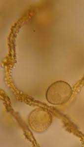 Attēlu rezultāti vaicājumam “Perichaena depressa spores”