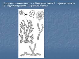 Attēlu rezultāti vaicājumam “Gloeocapsa rupestris”