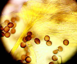 Attēlu rezultāti vaicājumam “Fuligo luteonitens macro”