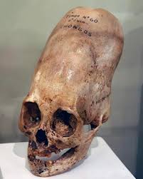 Image result for elongated skulls