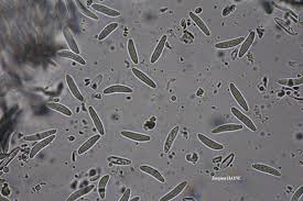 Attēlu rezultāti vaicājumam “Lecanactis abietina”