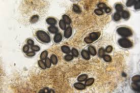 Attēlu rezultāti vaicājumam “Badhamia melanospora spores”