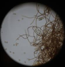 Attēlu rezultāti vaicājumam “Trichia flavicoma”