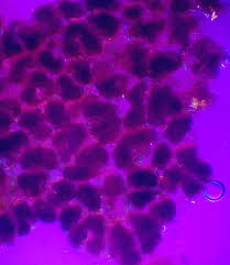 Attēlu rezultāti vaicājumam “Lycogala cf. fossiculatum sessile”