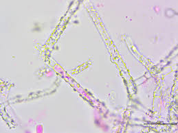 Attēlu rezultāti vaicājumam “Athelia pyriformis”