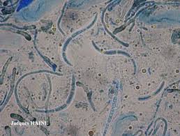 Attēlu rezultāti vaicājumam “Opegrapha rufescens”