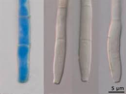 Attēlu rezultāti vaicājumam “Mycosphaerella millegrana”