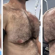 Image result for SYNTHOL