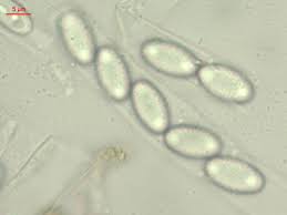 Attēlu rezultāti vaicājumam “Peziza flavida”