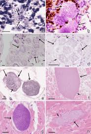 Attēlu rezultāti vaicājumam “undetermined plasmodium”