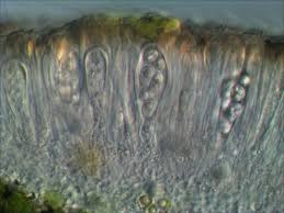 Attēlu rezultāti vaicājumam “Lecanora argentata”