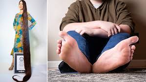 Image result for Amazing Feet Rc, Kidderminster