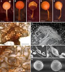 Attēlu rezultāti vaicājumam “Arcyria globosa spores”