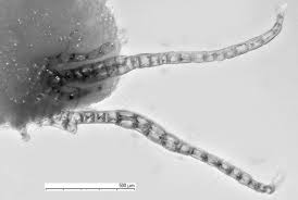 Attēlu rezultāti vaicājumam “Barbilophozia barbata”