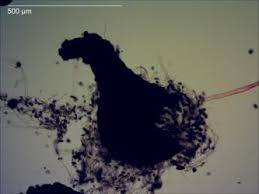 Attēlu rezultāti vaicājumam “Sordaria fimicola”