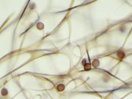 Attēlu rezultāti vaicājumam “Lamproderma pulchellum”