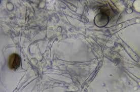 Attēlu rezultāti vaicājumam “Badhamia foliicola spores”