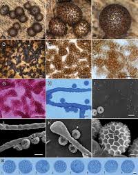 Attēlu rezultāti vaicājumam “Lycogala cf. fossiculatum sessile”