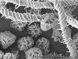 Attēlu rezultāti vaicājumam “Hemitrichia serpula spores”