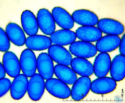Attēlu rezultāti vaicājumam “Sowerbyella radiculata”