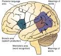 Siloam Family Health Center: Medical Monday - What is Aphasia?