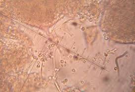 Attēlu rezultāti vaicājumam “Physarum licheniforme”