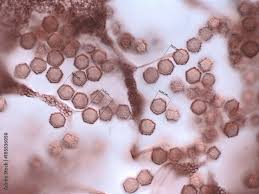 Attēlu rezultāti vaicājumam “myxomicetes”