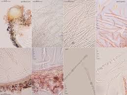 Attēlu rezultāti vaicājumam “Torrubiella arachnophila”