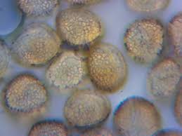 Attēlu rezultāti vaicājumam “Hemitrichia decipiens var. hemitrichoides spores”