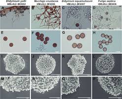 Attēlu rezultāti vaicājumam “Fuligo septica var. candida spores”