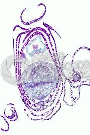 Attēlu rezultāti vaicājumam “Sphagnum centrale sporophyte”