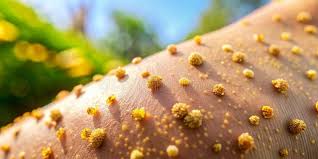 Image result for 春粒