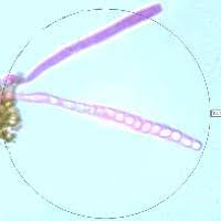 Attēlu rezultāti vaicājumam “Hypocrea rufa”