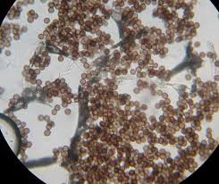 Attēlu rezultāti vaicājumam “Badhamia dubia”