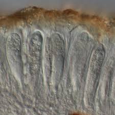 Attēlu rezultāti vaicājumam “Lecanora conizaeoides”