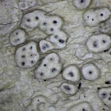 Attēlu rezultāti vaicājumam “Pertusaria pertusa”