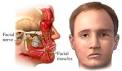 <b>Nerves</b> at Risk in <b>Facial</b>