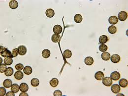 Attēlu rezultāti vaicājumam “Reticularia jurana spores”