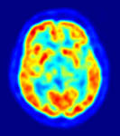 File: PET -image.jpg - Wikipedia, the free encyclopedia