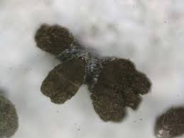 Attēlu rezultāti vaicājumam “Chaenotheca ferruginea”